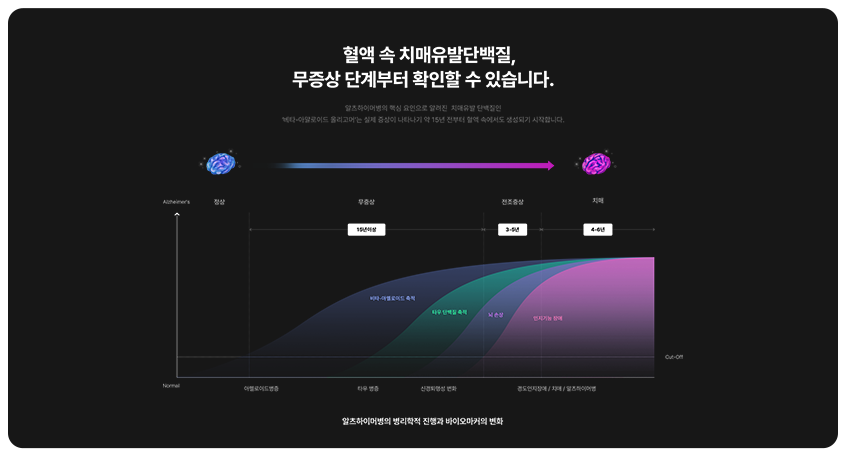 알츠온 이미지