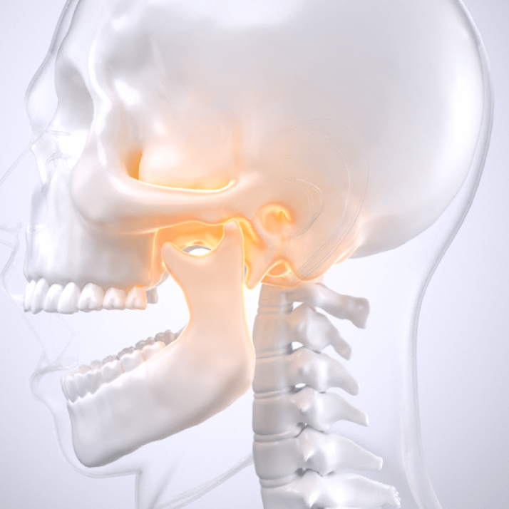 턱관절장애 3D