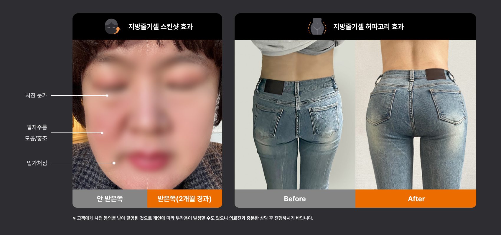 시술 전후 비교 인포그래픽