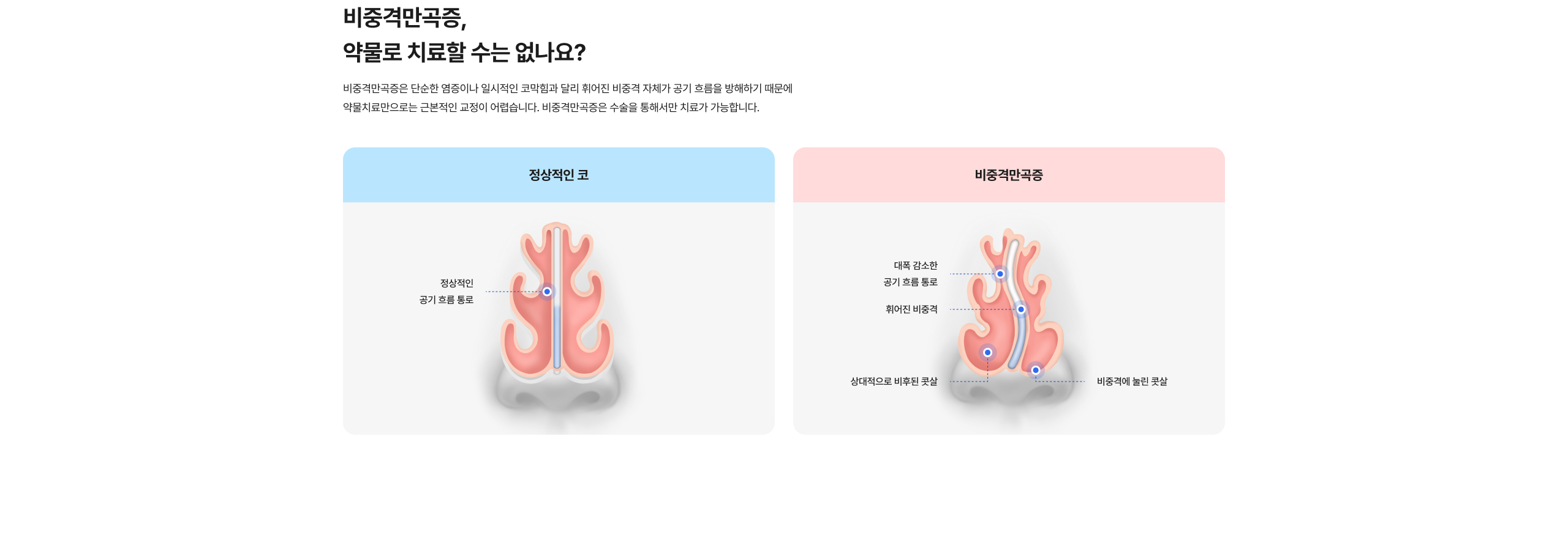 삼성드림이비인후과 상세 화면 55