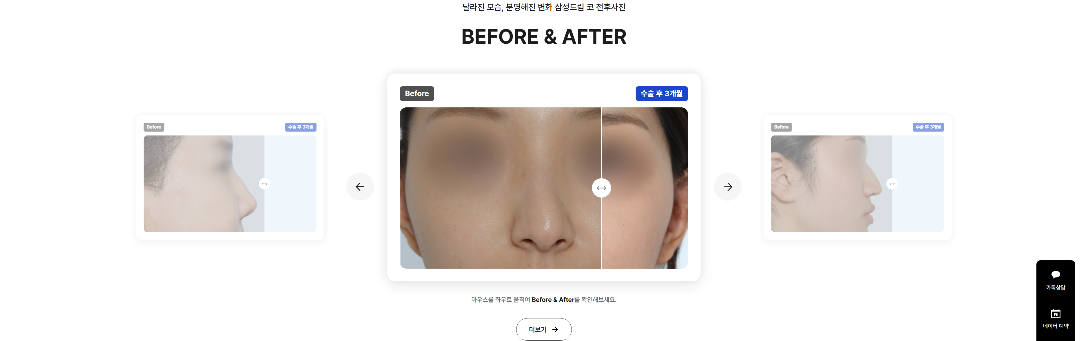 Before & After 비교 슬라이더 화면